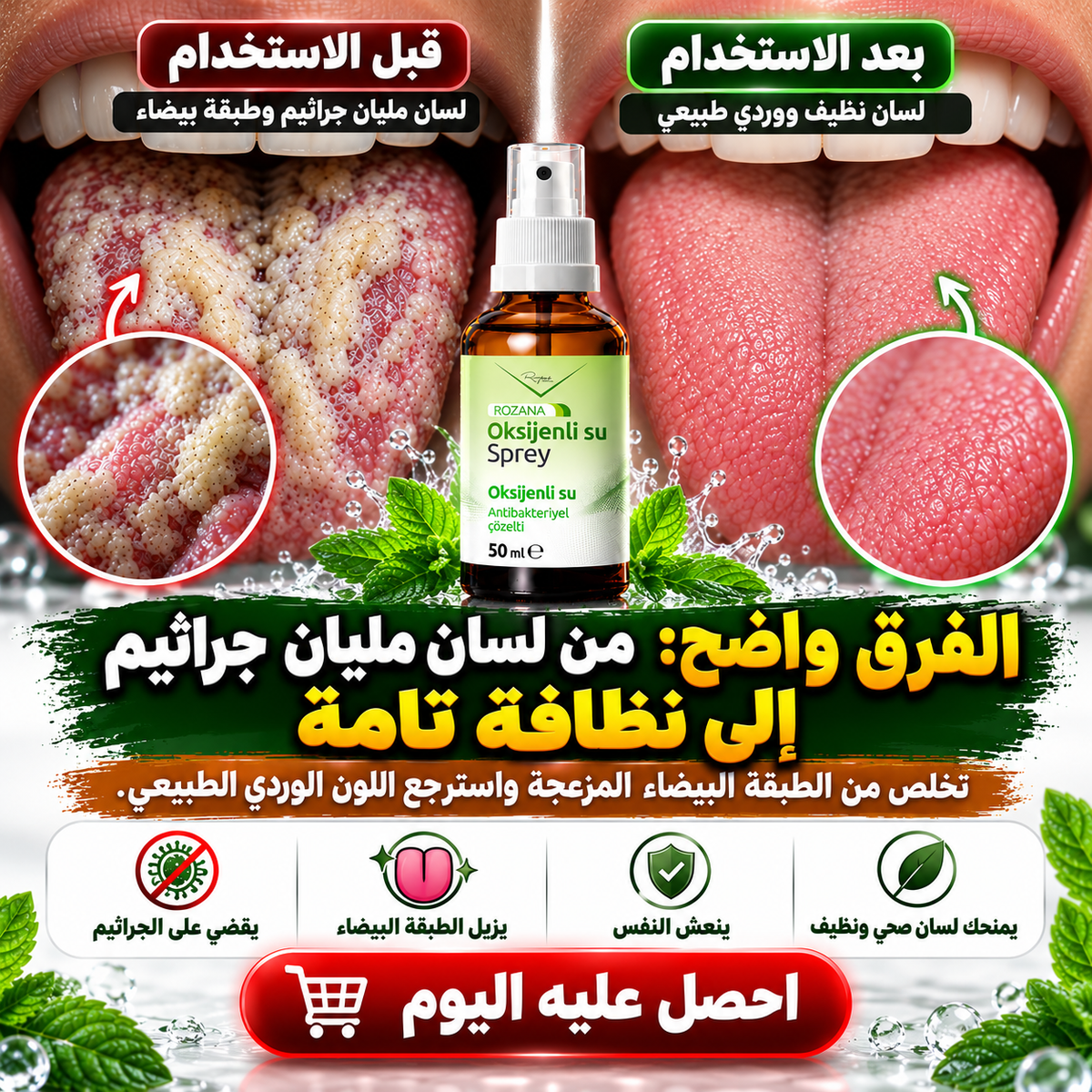بخاخ الأكسجين لعلاج فطريات الفم