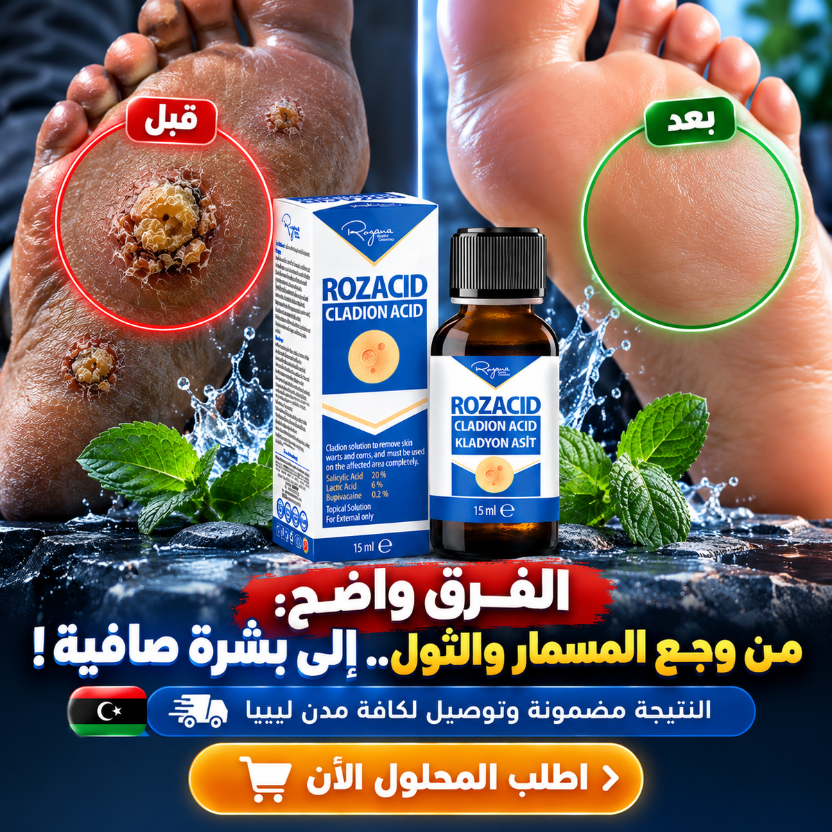محلول علاج الثولال و مسمار القدم