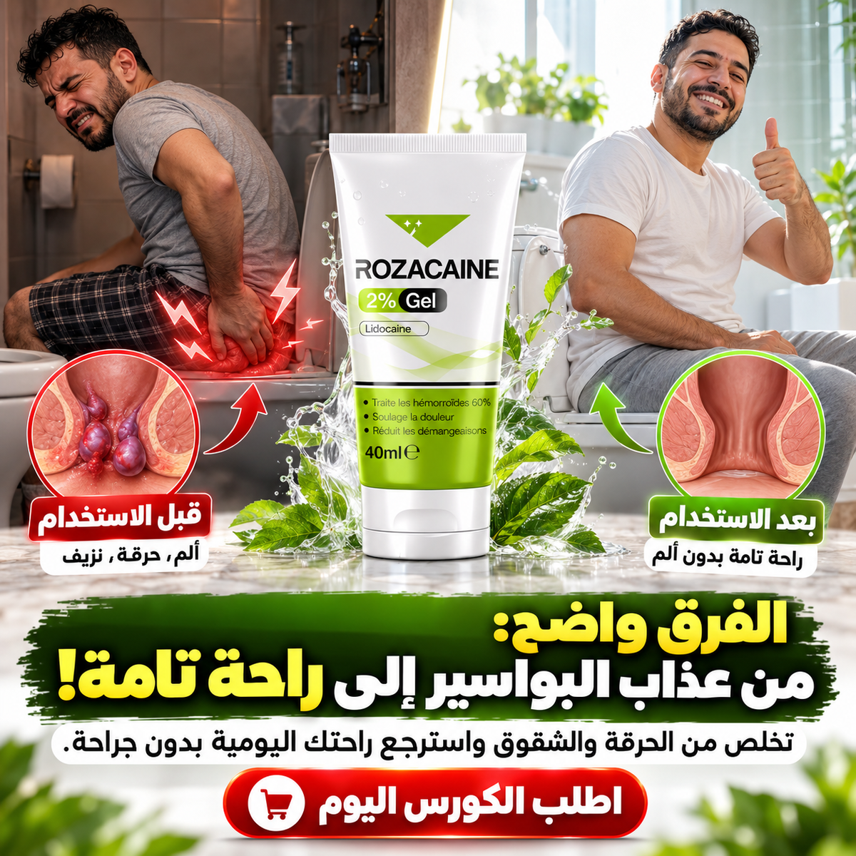 جل علاج النهائي للبواسير و النسور