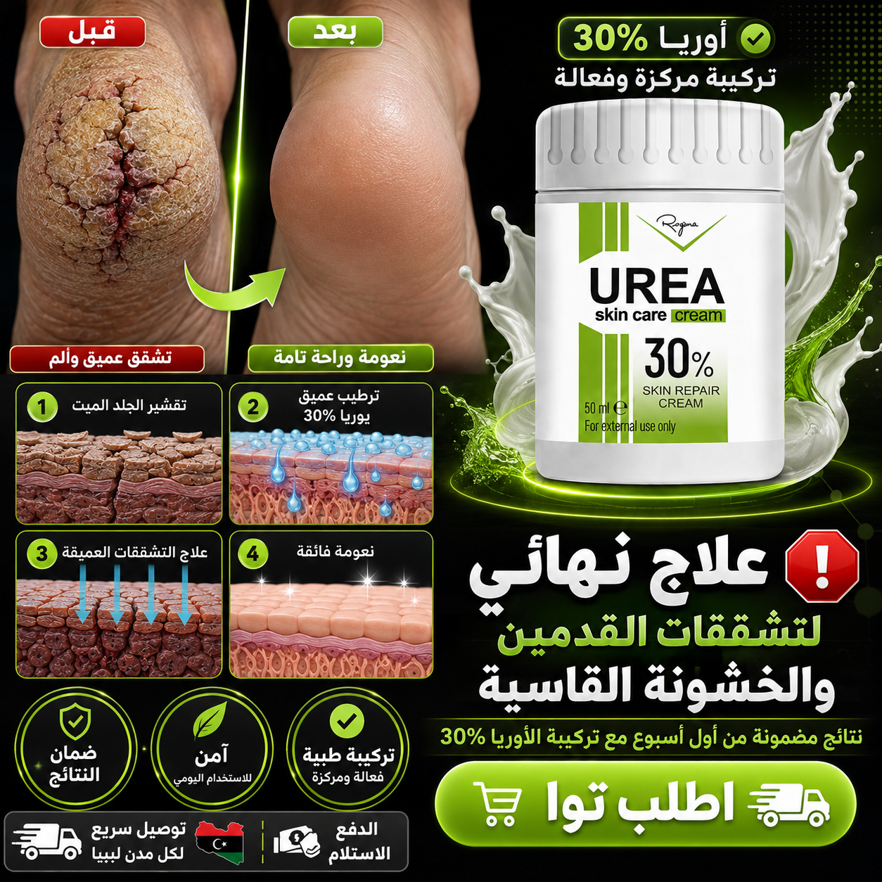 كريم علاج القدم السكري