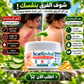 كريم علاج الحروق و الندبات ScarReviva
