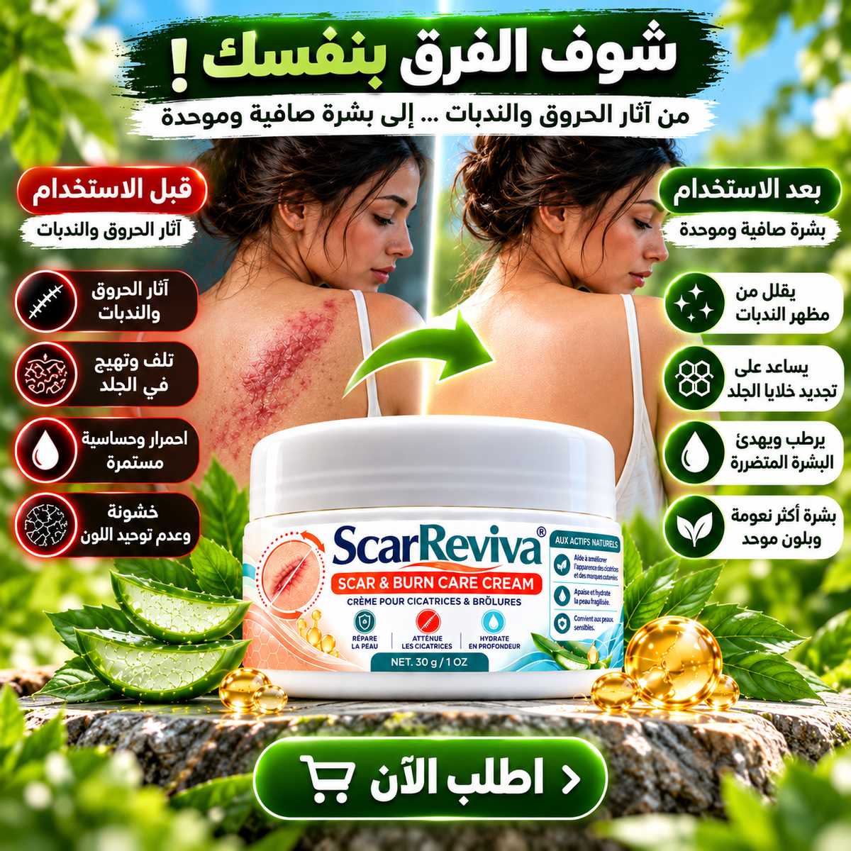 كريم علاج الحروق و الندبات ScarReviva